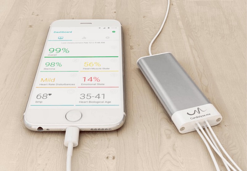 Cardiolyse application and ECG recorder