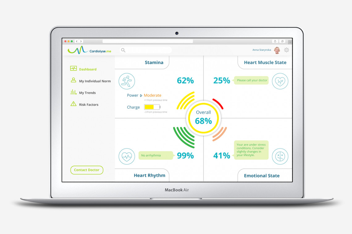 mobile ecg device